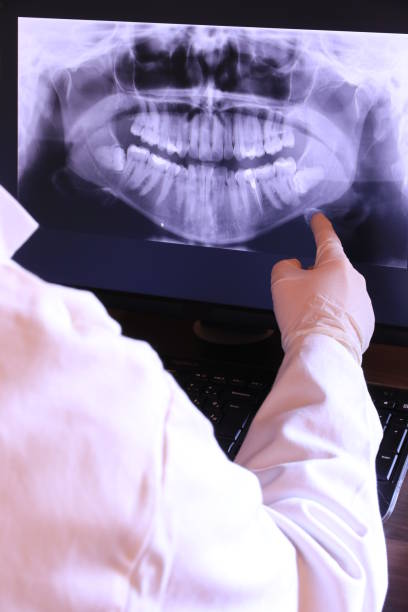 Best Emergency Treatment for Dental Infections or Abscesses in Milbank, SD